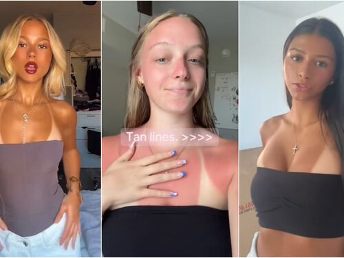 Attenti a questo trend: la "Sunburn challenge", l'ultima folle sfida dei social che può costare cara alla pelle