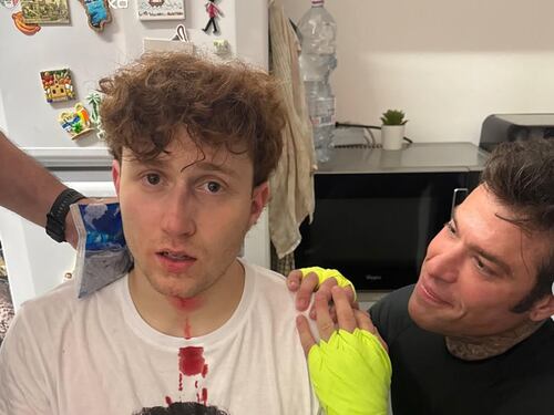 Fedez rompe il naso al Rosso in diretta, la corsa in ospedale: cosa è successo