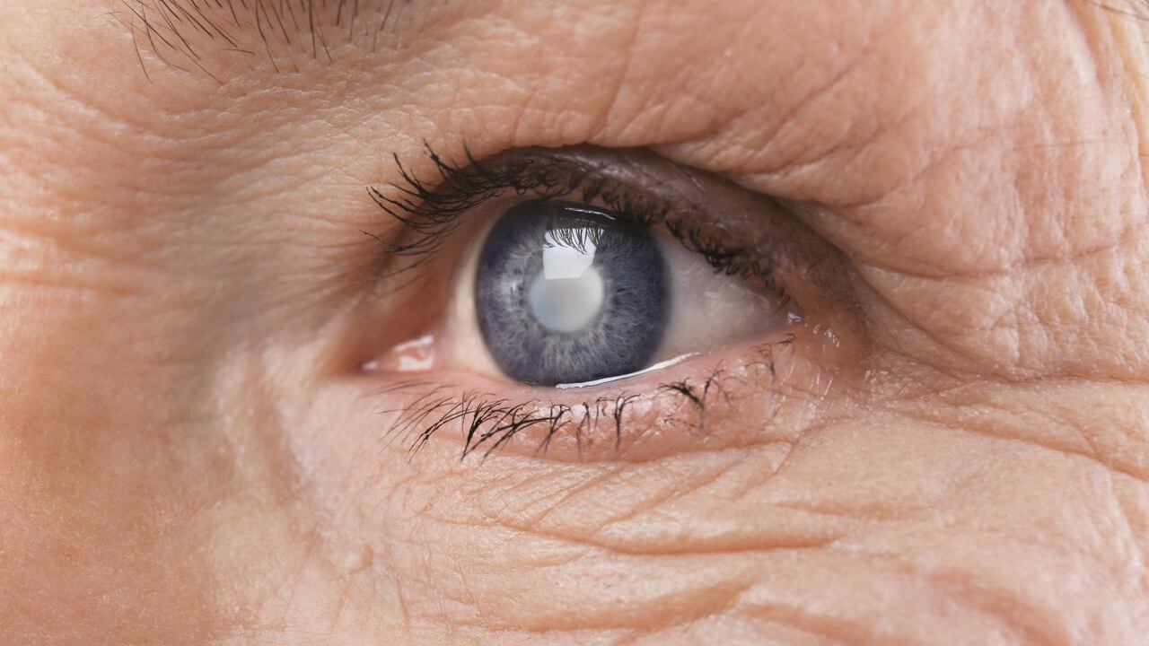 Via cataratta senza operarsi, dal segreto di uno scoiattolo possibile farmaco