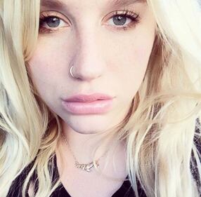 Kesha su Instagram, foto 14
