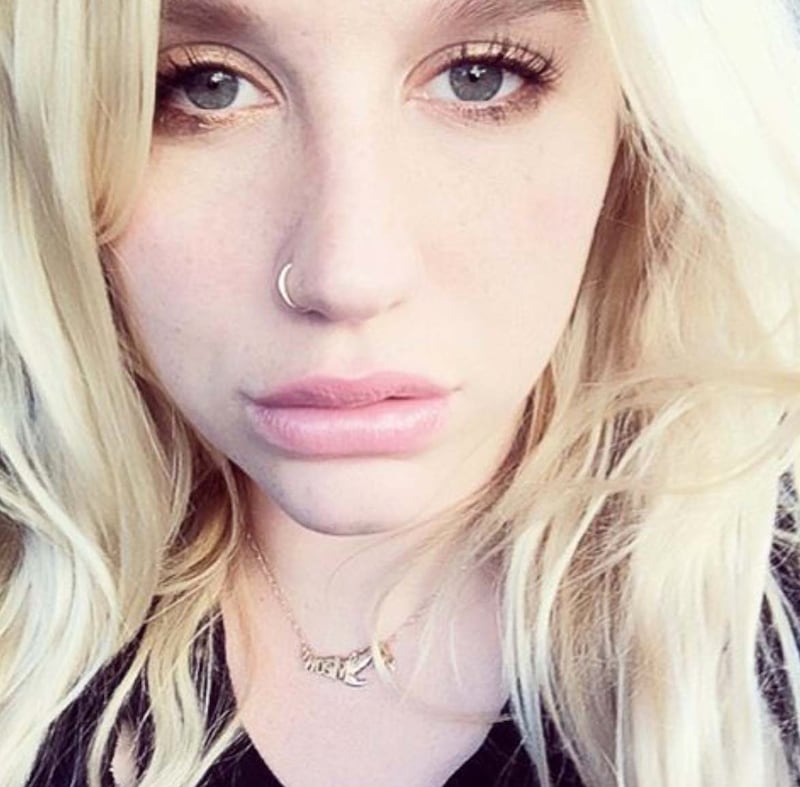 Kesha su Instagram, foto 14
