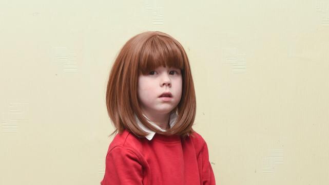 Bimba soffre di alopecia e i bulli la deridono: scuola vieta la parrucca