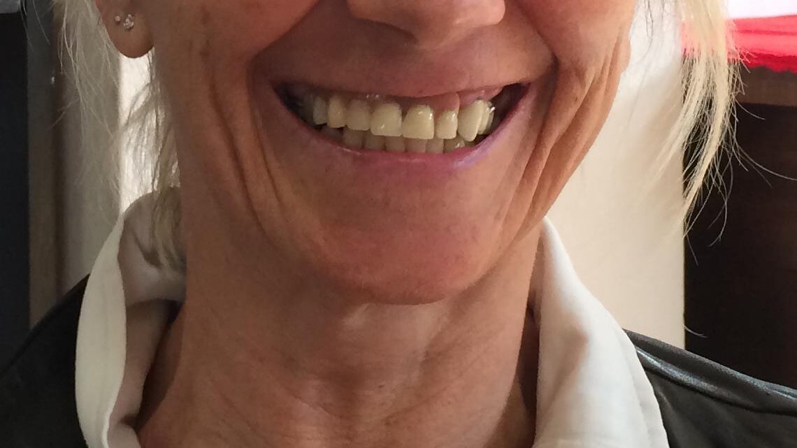 «Il battito del suo cuore mi ha convinto a non abortire»