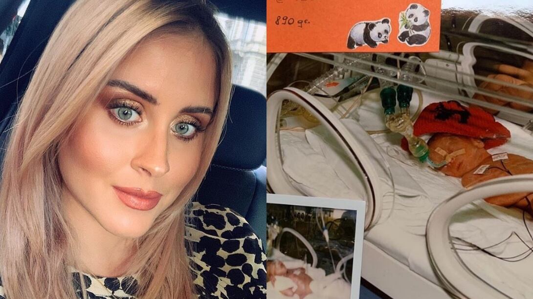 Valentina Ferragni: "Nata prematura, pesavo solo 890 grammi. Non sapevano se sarei sopravvissuta"