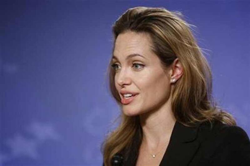 Angelina Jolie troppo magra, Brad Pitt le lancia un ultimatum 27