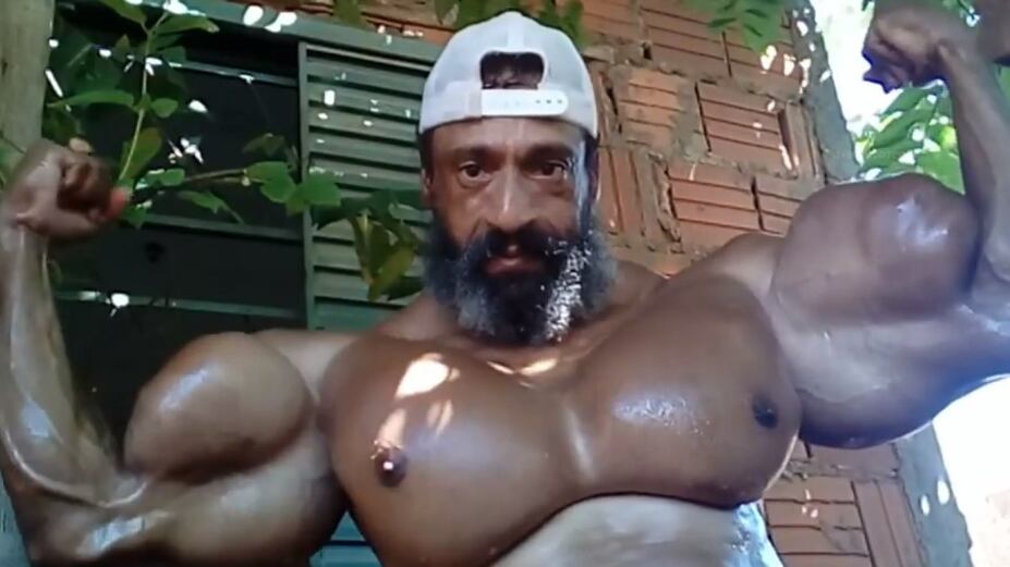 Si inietta per anni liquido gonfia-muscoli: morto "Hulk brasiliano"