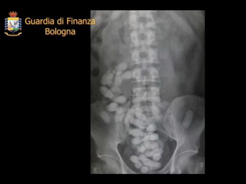 Bologna, pusher straniero fermato in aeroporto: trasportava 113 ovuli