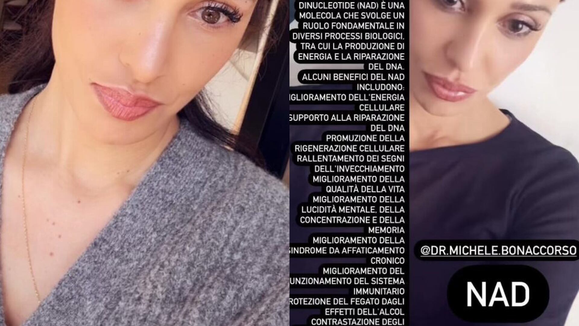 Belen e il trattamento Nad per "ringiovanire": di cosa si tratta