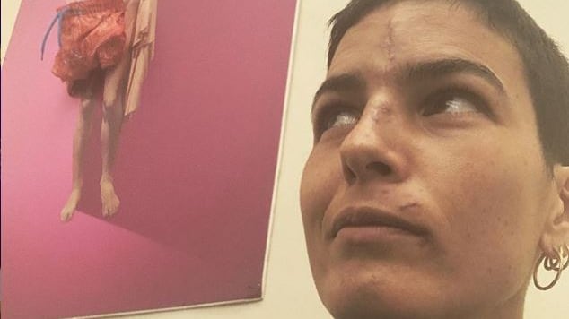 L'appello di Edelfa Chiara Masciotta dopo l'incidente: "Rispettiamo il codice della strada"