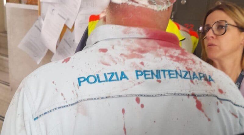 Le foto degli agenti picchiati dai detenuti nelle carceri 3