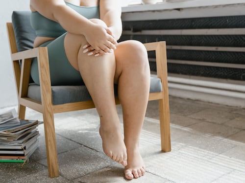 Il dolore, il bruciore, il “segno del calzino”. Cosa c’è dietro al lipedema, come riconoscerlo e come gestirlo