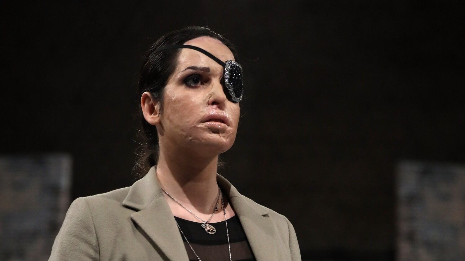Gessica sfregiata: "L'amore frustrato non è un'attenuante"