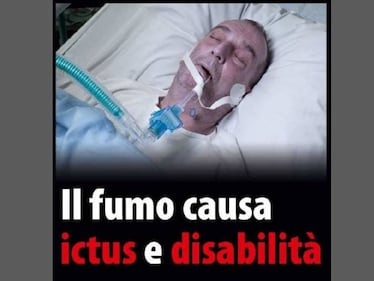 Le foto choc sui pacchetti di sigarette 14