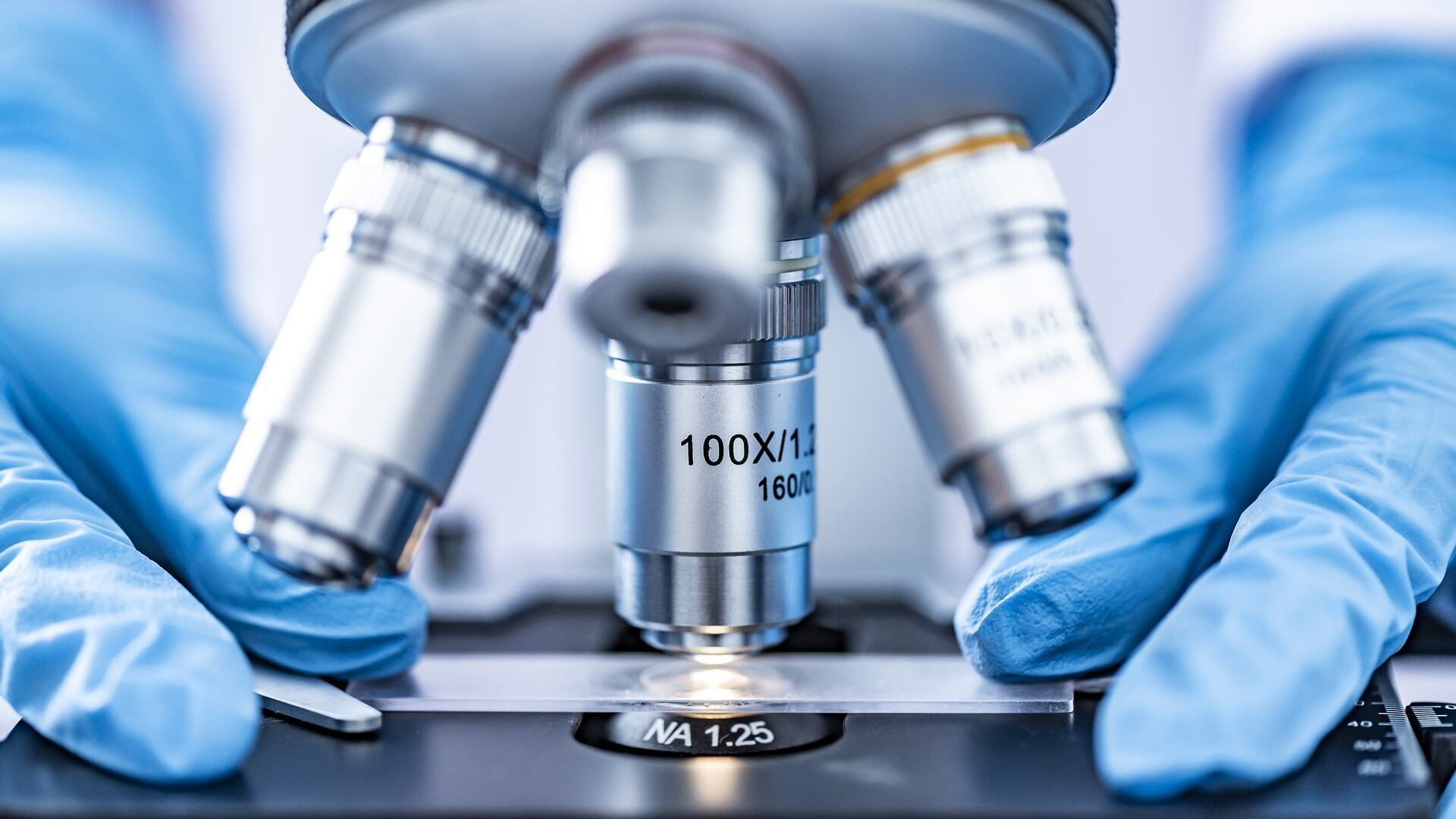 Hiv, secondo caso di guarigione dal virus senza farmaci