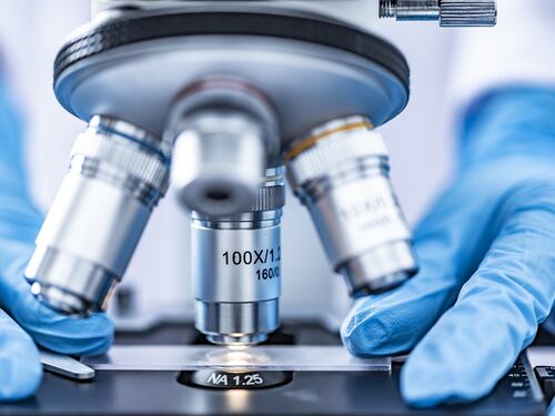 Hiv, secondo caso di guarigione dal virus senza farmaci