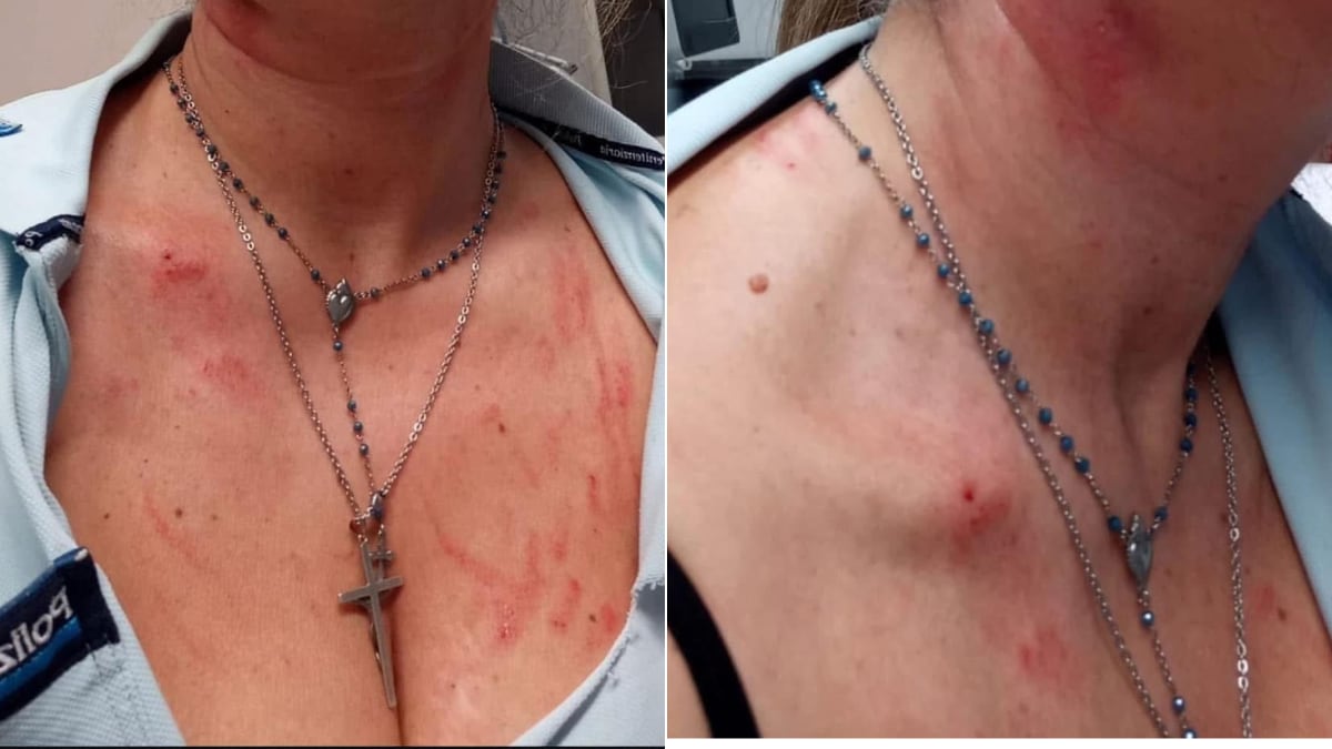 Calci, morsi, poi la violenza: la furia dello straniero contro un'agente. "In Marocco donne sottomesse"