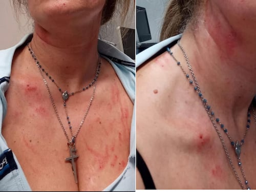 Calci, morsi, poi la violenza: la furia dello straniero contro un'agente. "In Marocco donne sottomesse"