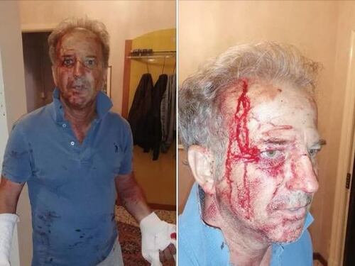 Migranti massacrano poliziotto. Pugnalato a sangue in casa: le foto choc