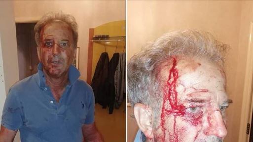 Migranti massacrano poliziotto. Pugnalato a sangue in casa: le foto choc