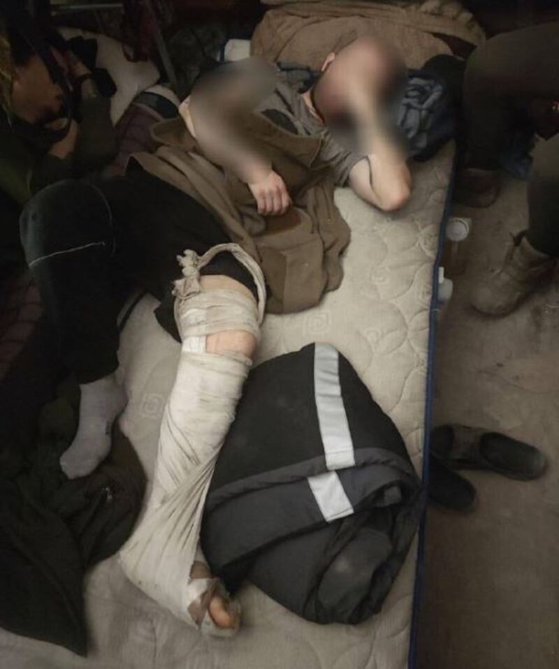 Le foto choc dall'ospedale dell'acciaieria Azovstal 4