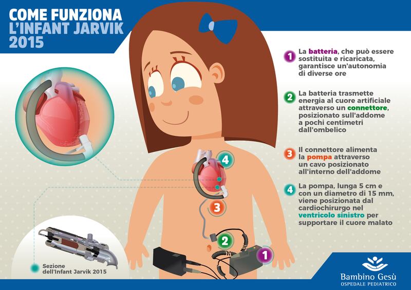 minicuore infografica