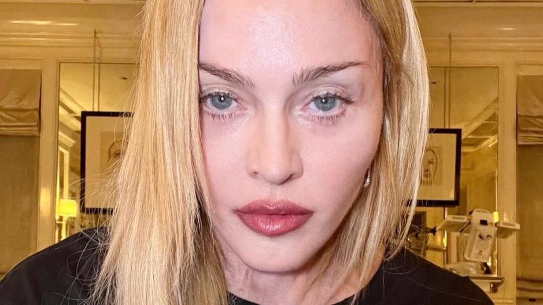 "Sarò presto sul palco". Madonna riappare dopo il coma