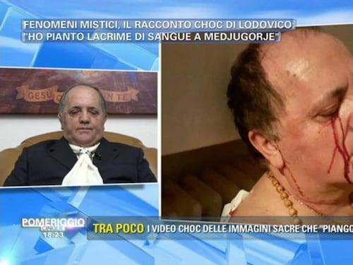 Pomeriggio 5, ex malato terminale piange lacrime di sangue