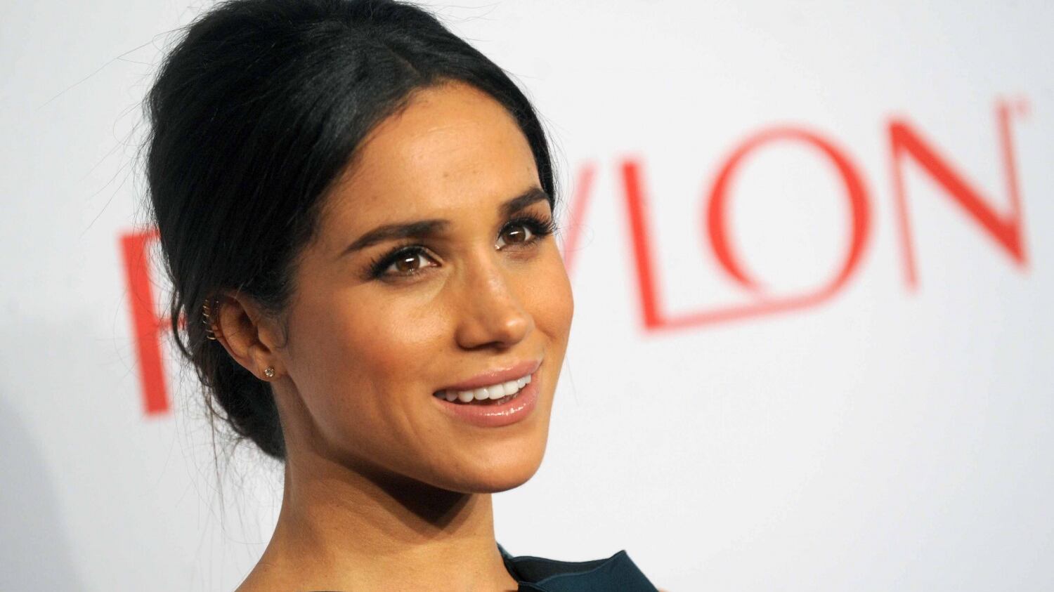 Chirurgia plastica: tutte vogliono un naso alla Meghan Markle