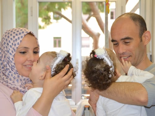 A Roma separate due gemelle siamesi algerine: ora stanno bene