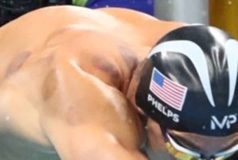 I segni della coppettazione sulla schiena di Michael Phelps