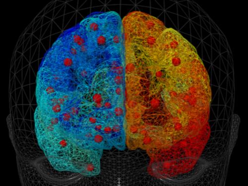 La fisica per curare le malattie: così crea cervelli umani virtuali