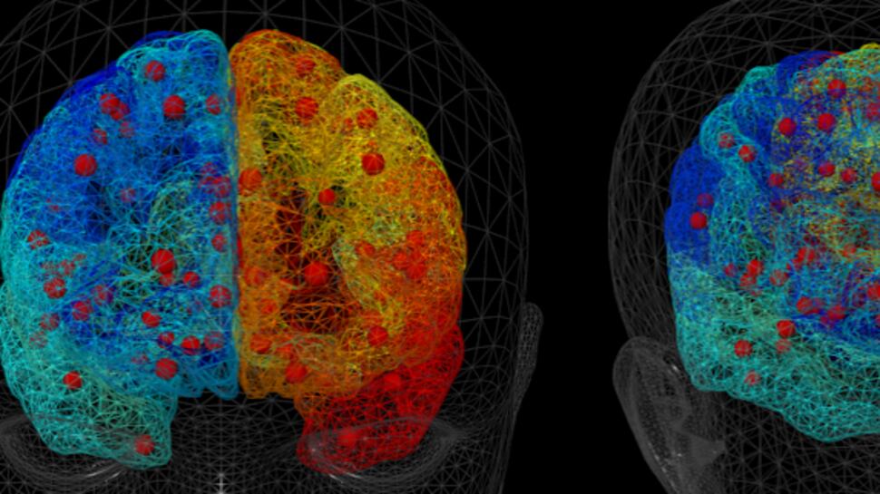 La fisica per curare le malattie: così crea cervelli umani virtuali