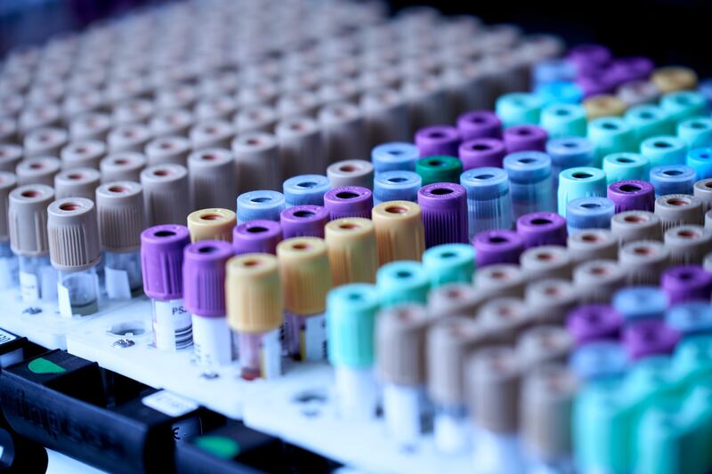 Esami del sangue completi, cosa c'è da sapere per interpretarli