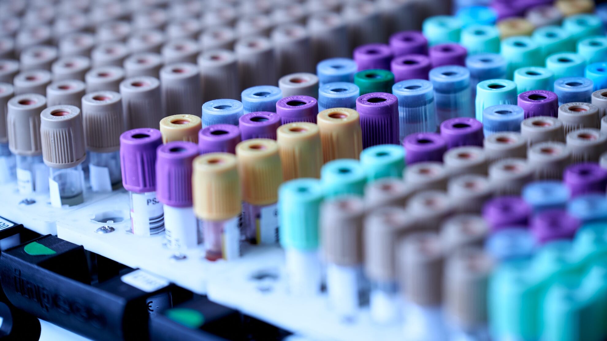Esami del sangue completi, cosa c'è da sapere per interpretarli