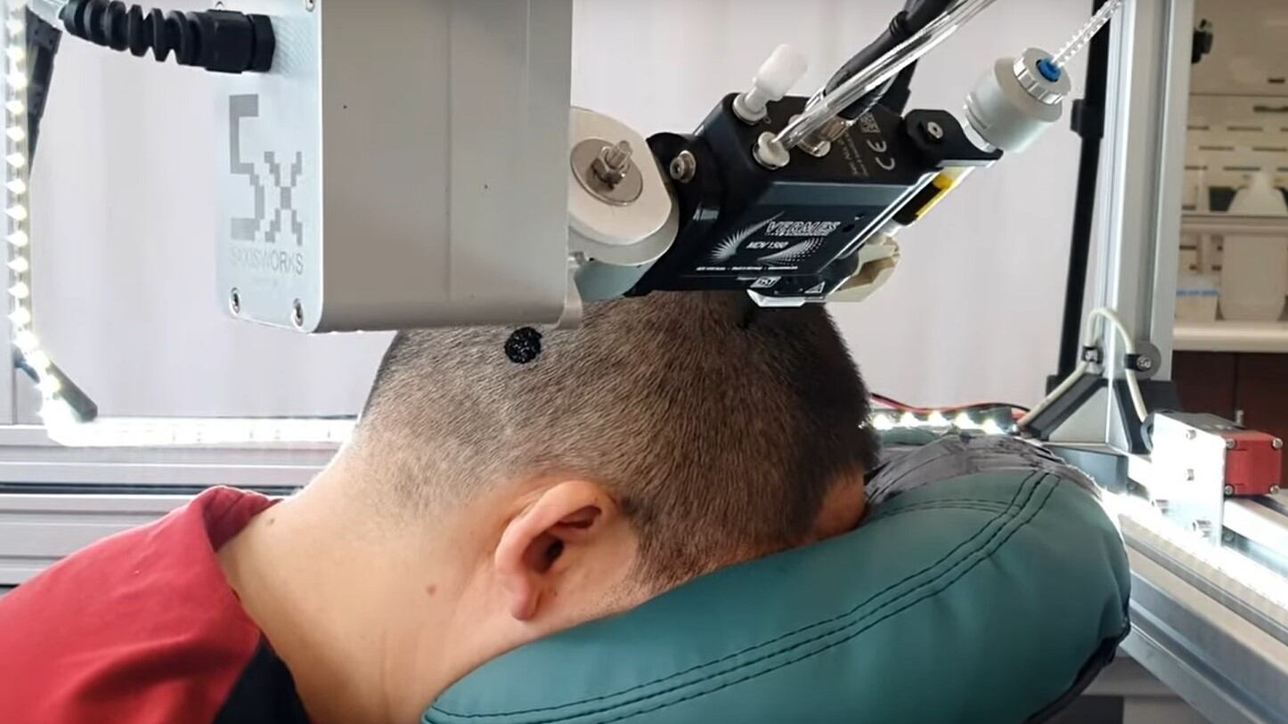 "Meglio dell'encefalogramma". Un tatuaggio sulla testa per misurare le onde cerebrali