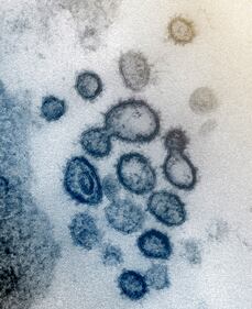 Le nuove immagini del coronavirus 3