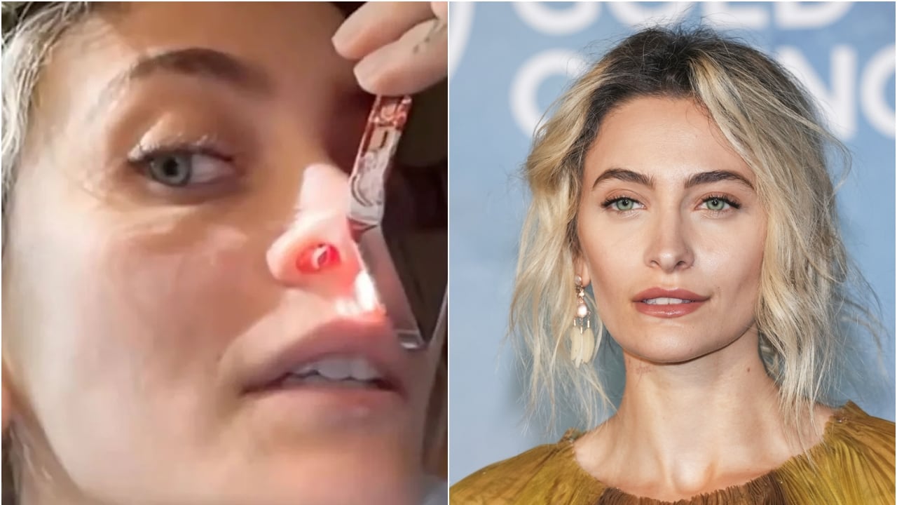 "Setto nasale perforato dalla droga". Il video choc di Paris Jackson