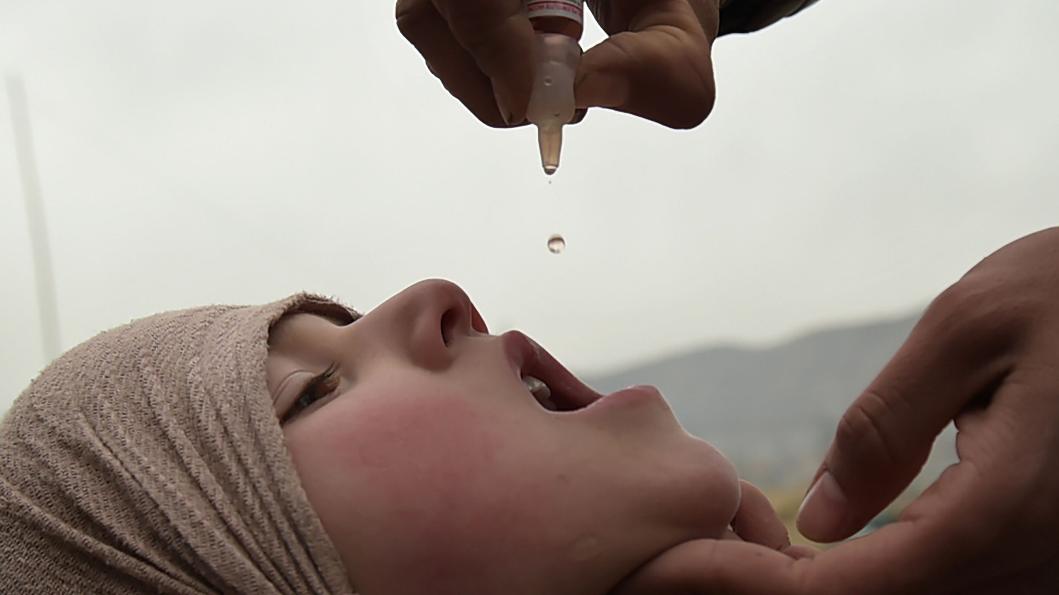 Usa, paralisi simil polio fa paura. Colpiti sei bambini in pochi giorni