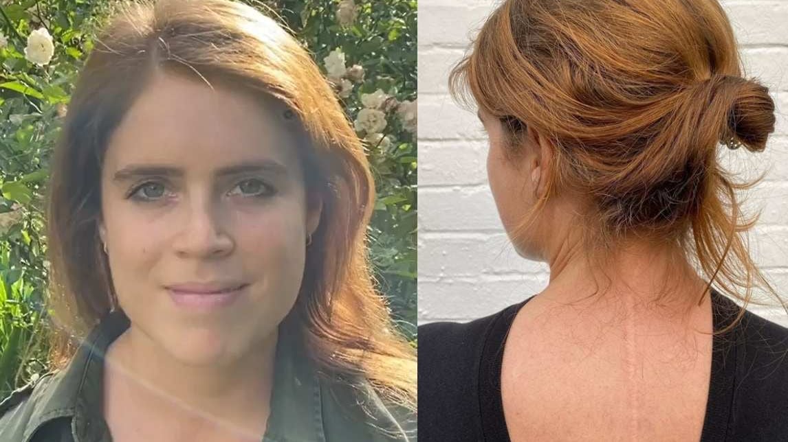 Quella foto choc della principessa. E il ricordo di un doloroso trauma