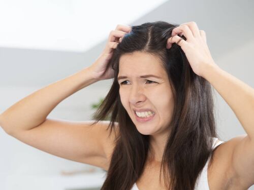 I rimedi naturali per combattere la dermatite seborroica