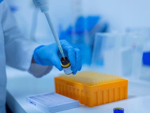 Alzheimer, aumentare i livelli di una molecola chiave protegge dalla malattia