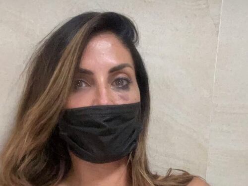 "Ridurla così…". Il volto tumefatto, poi la foto di Guendalina Tavassi sparisce