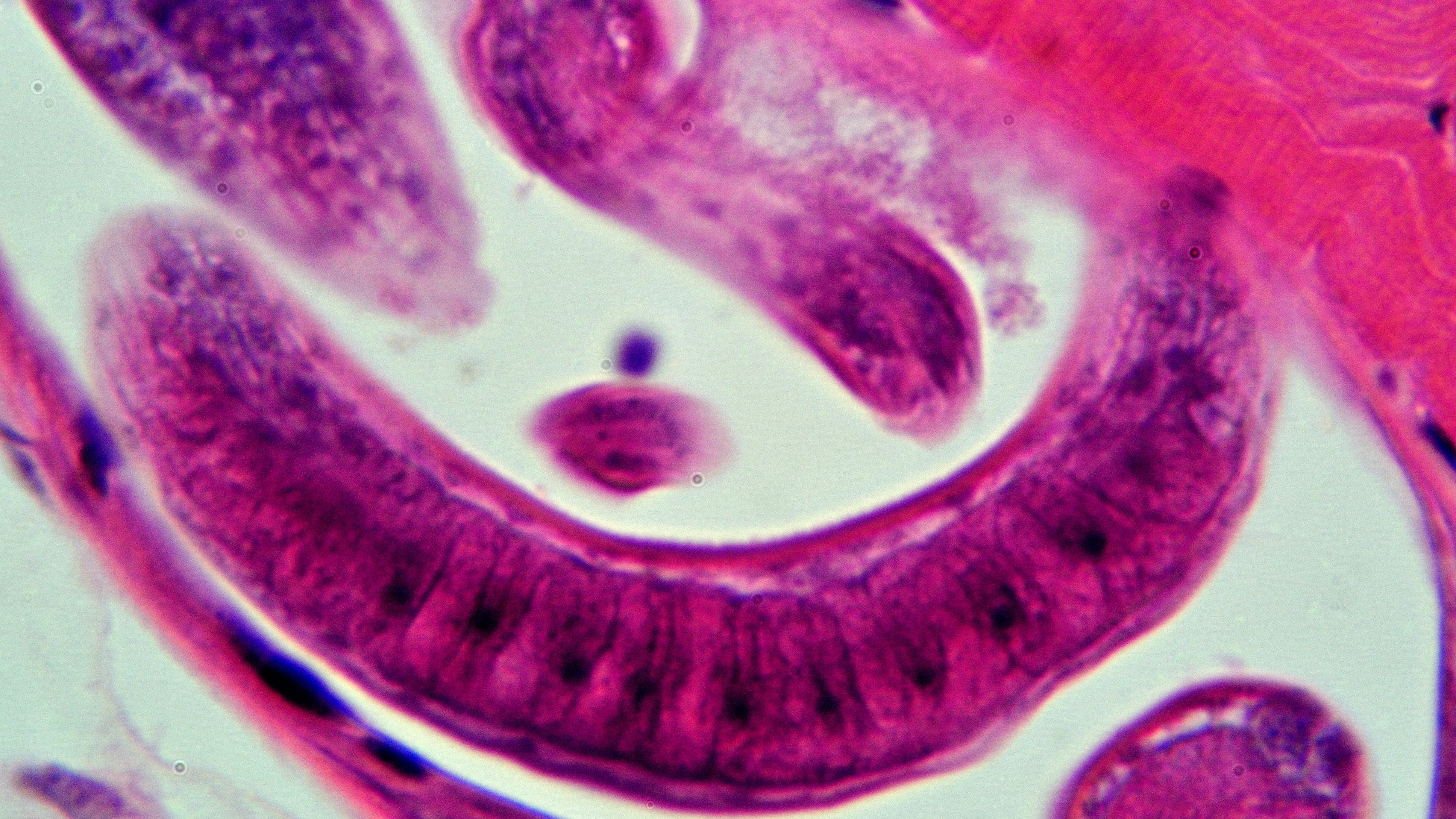 Allerta cinghiale infetto: "Il batterio trichinella è letale per l'uomo"