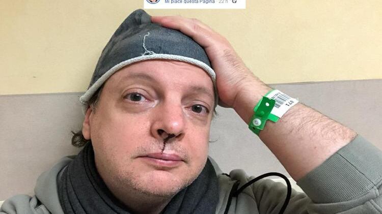 Dado a processo per diffamazione dopo le denunce dell'ex della figlia