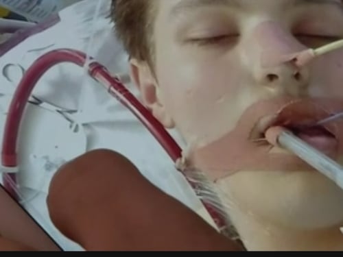 La storia di Ewan: "Ho rischiato la vita per lo svapo"