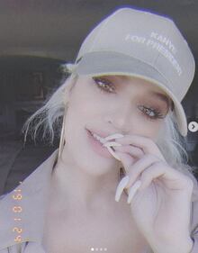Khloe Kardashian sempre più irriconoscibile 7