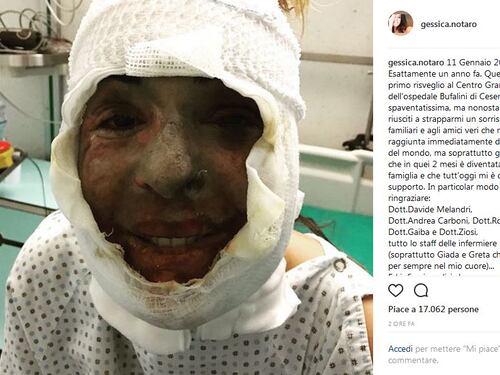 Gessica Notaro posta il primo selfie scattato dopo l'agguato dell'ex
