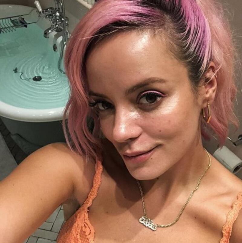 Lily Allen, le immagini più sexy 3