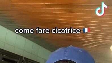 Cicatrice francese, Agcom chiede a TikTok di eliminare i video sulla sfida