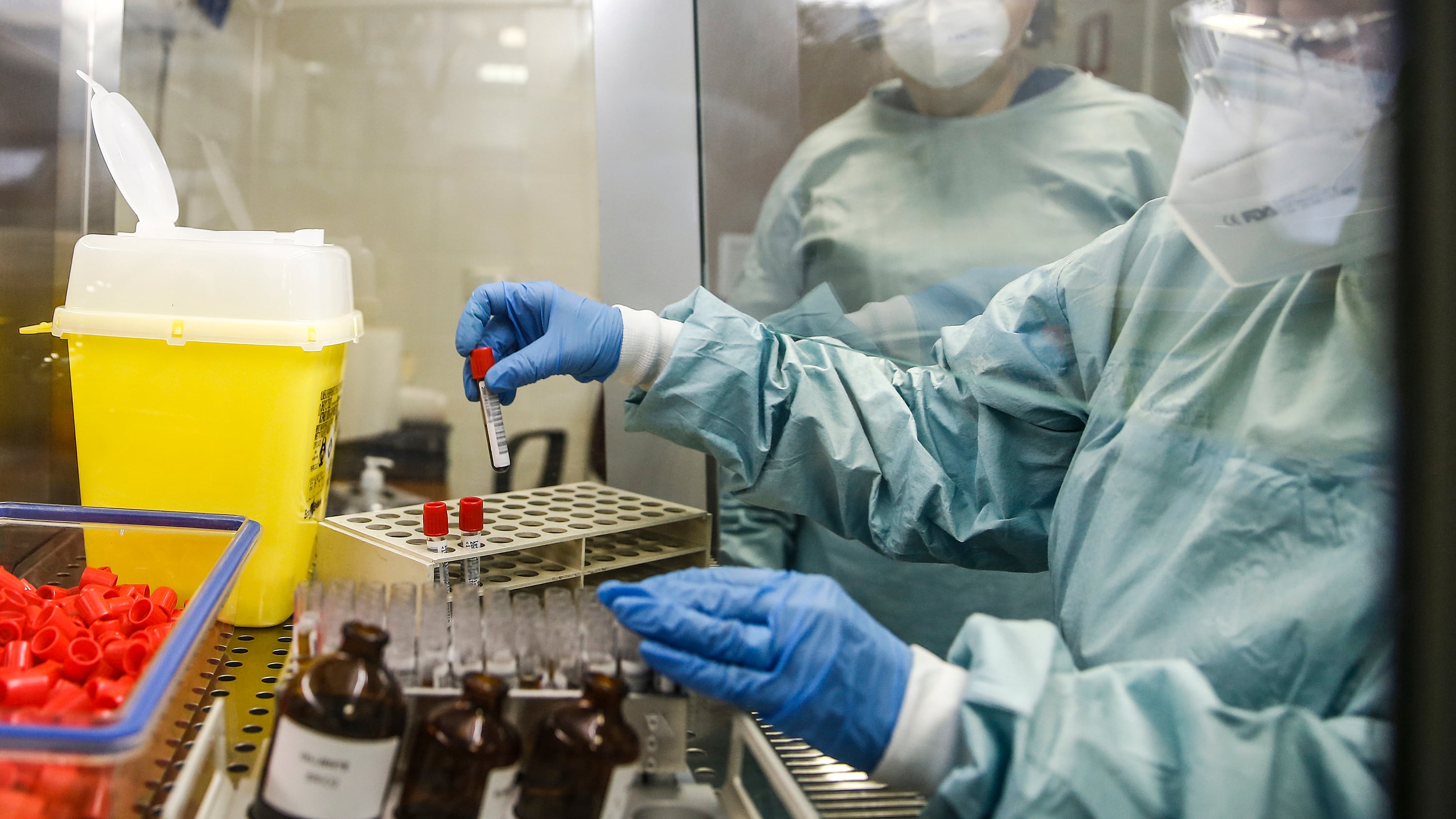 L'Iss: "Parti del virus sono presenti nelle mascherine dopo 7 giorni"